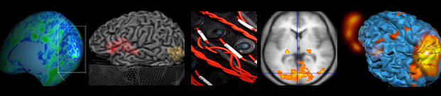 Lab Session C: Brain structure and function: a multimodal overview