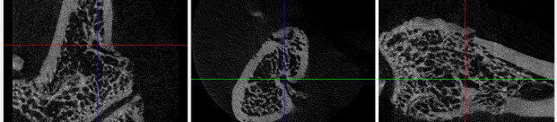 Lab Session A: Micro-computed tomography (micro-CT) image acquisition and analysis for biomedical research